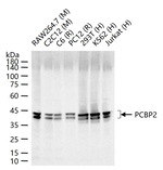 PCBP2 Antibody in Western Blot (WB)