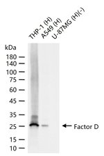 Factor D Recombinant Rabbit Monoclonal Antibody (11C8)