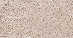 CLIC4 Antibody in Immunohistochemistry (Paraffin) (IHC (P))