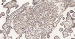 CLIC4 Antibody in Immunohistochemistry (Paraffin) (IHC (P))