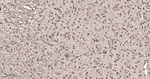 CLIC4 Antibody in Immunohistochemistry (Paraffin) (IHC (P))
