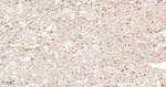CLIC4 Antibody in Immunohistochemistry (Paraffin) (IHC (P))