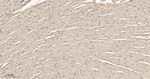 CLIC4 Antibody in Immunohistochemistry (Paraffin) (IHC (P))