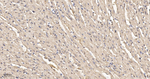 CLIC4 Antibody in Immunohistochemistry (Paraffin) (IHC (P))