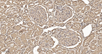 CLIC4 Antibody in Immunohistochemistry (Paraffin) (IHC (P))