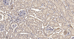 CLIC4 Antibody in Immunohistochemistry (Paraffin) (IHC (P))
