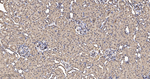 CLIC4 Antibody in Immunohistochemistry (Paraffin) (IHC (P))