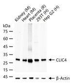 CLIC4 Antibody in Western Blot (WB)