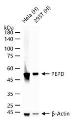 PEPD Antibody in Western Blot (WB)