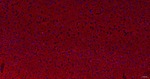HOMER1 Antibody in Immunohistochemistry (Paraffin) (IHC (P))