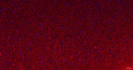 HOMER1 Antibody in Immunohistochemistry (Paraffin) (IHC (P))