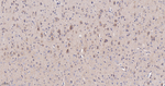 NDUFS2 Antibody in Immunohistochemistry (Paraffin) (IHC (P))