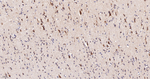 NDUFS2 Recombinant Rabbit Monoclonal Antibody (9F2)