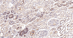 NDUFS2 Antibody in Immunohistochemistry (Paraffin) (IHC (P))