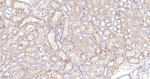 NDUFS2 Antibody in Immunohistochemistry (Paraffin) (IHC (P))
