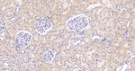 NDUFS2 Antibody in Immunohistochemistry (Paraffin) (IHC (P))