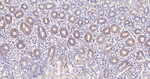 NDUFS2 Antibody in Immunohistochemistry (Paraffin) (IHC (P))