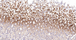 NDUFS2 Antibody in Immunohistochemistry (Paraffin) (IHC (P))