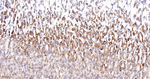 NDUFS2 Antibody in Immunohistochemistry (Paraffin) (IHC (P))