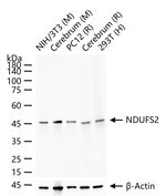 NDUFS2 Antibody in Western Blot (WB)