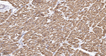 NDUFC2 Antibody in Immunohistochemistry (Paraffin) (IHC (P))