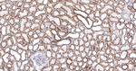 NDUFC2 Antibody in Immunohistochemistry (Paraffin) (IHC (P))