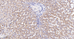 NDUFC2 Antibody in Immunohistochemistry (Paraffin) (IHC (P))