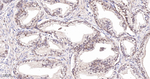 CRCP Recombinant Rabbit Monoclonal Antibody (11D9)