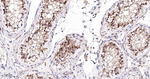 CRCP Antibody in Immunohistochemistry (Paraffin) (IHC (P))