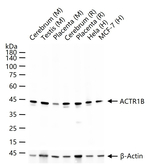 ACTR1B Recombinant Rabbit Monoclonal Antibody (3C12)