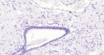 Phospho-c-Jun (Thr91, Thr93) Antibody in Immunohistochemistry (Paraffin) (IHC (P))