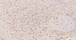 ATE1 Antibody in Immunohistochemistry (Paraffin) (IHC (P))