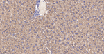 ATE1 Antibody in Immunohistochemistry (Paraffin) (IHC (P))