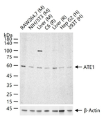 ATE1 Antibody in Western Blot (WB)