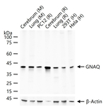 GNAQ Recombinant Rabbit Monoclonal Antibody (6D2)