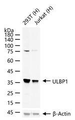 ULBP1 Recombinant Rabbit Monoclonal Antibody (7E4)