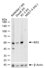 RIP2 Recombinant Rabbit Monoclonal Antibody (5G4)