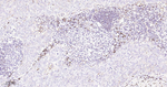 IKK beta Antibody in Immunohistochemistry (Paraffin) (IHC (P))