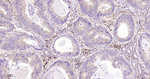 IKK beta Antibody in Immunohistochemistry (Paraffin) (IHC (P))