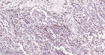 IKK beta Antibody in Immunohistochemistry (Paraffin) (IHC (P))