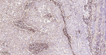 IKK beta Recombinant Rabbit Monoclonal Antibody (9H19)