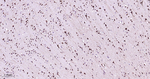eIF3a Antibody in Immunohistochemistry (Paraffin) (IHC (P))