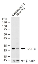 PDGF-B Recombinant Rabbit Monoclonal Antibody (12F5)