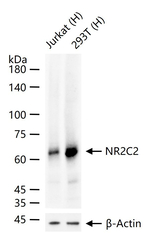 NR2C2 Antibody in Western Blot (WB)