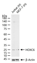 HOXC6 Recombinant Rabbit Monoclonal Antibody (12F5)