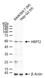 Cdc73 Recombinant Rabbit Monoclonal Antibody (2G7)