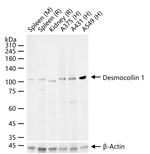 DSC1 Recombinant Rabbit Monoclonal Antibody (10G4)