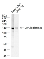 Ceruloplasmin Recombinant Rabbit Monoclonal Antibody (5G11)