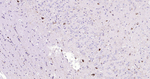 Somatostatin Antibody in Immunohistochemistry (Paraffin) (IHC (P))