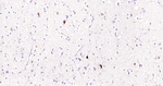 Somatostatin Antibody in Immunohistochemistry (Paraffin) (IHC (P))